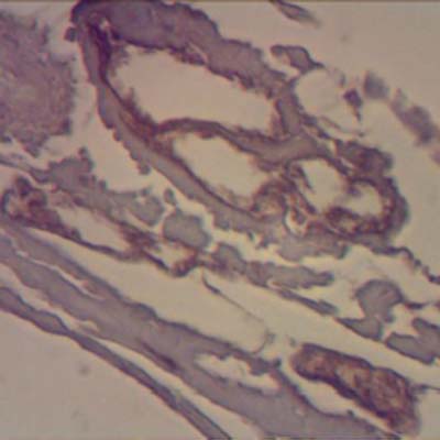 Laminin